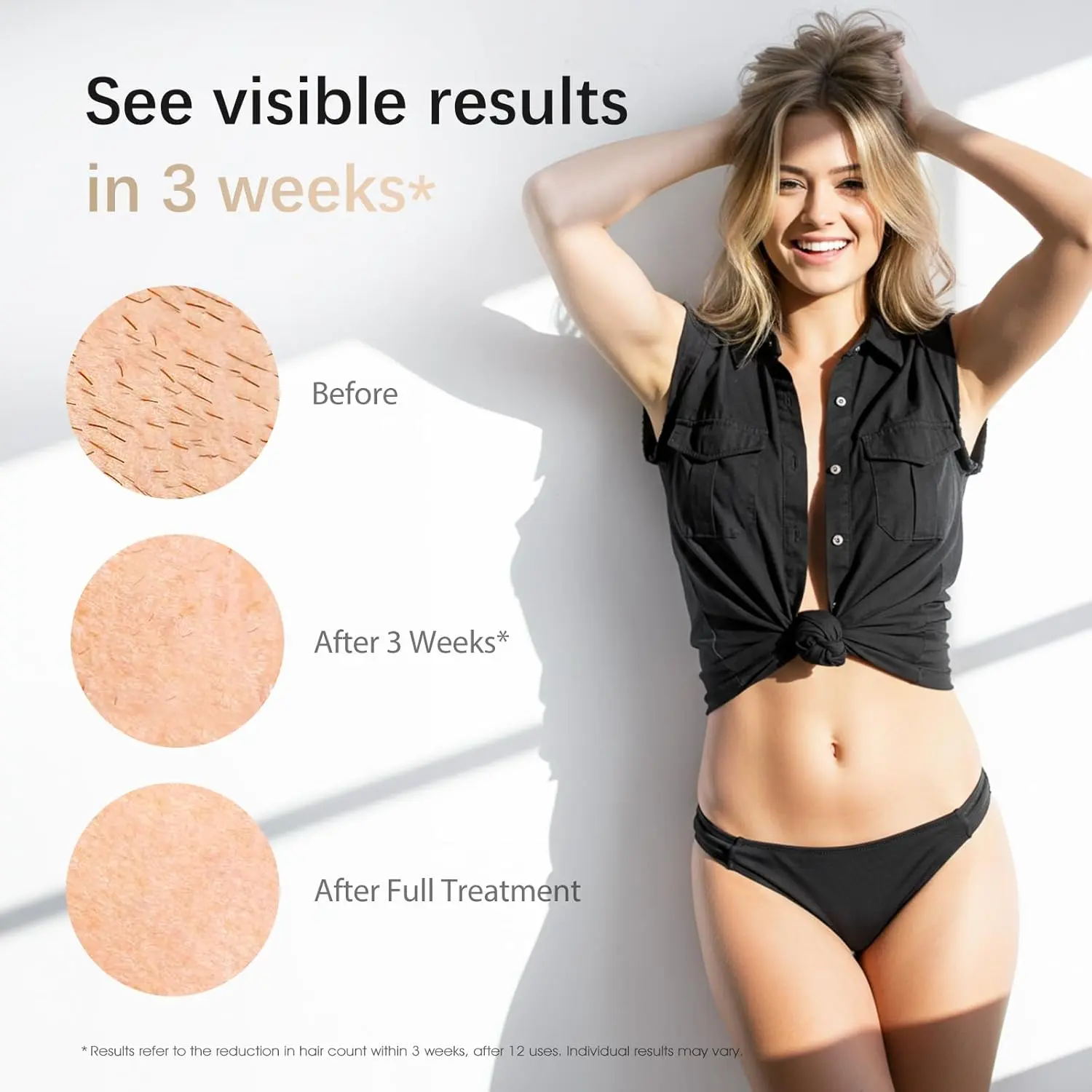 Amotaos IPL Hair Removal Visible Results